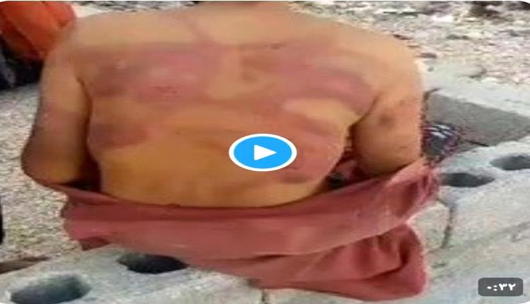 ظهور فيديوهات جديدة تورط عمان بتعذيب اليمنيين !
