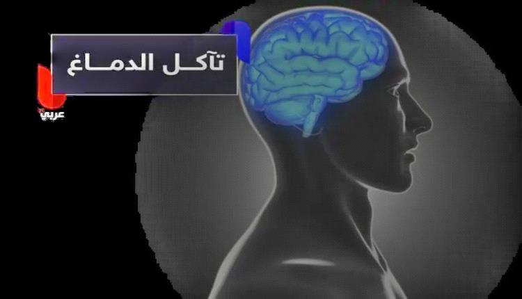 هل قلة النوم تسرق سنوات من عمر دماغك؟